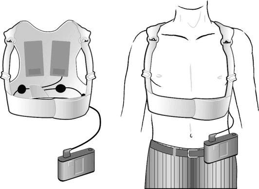 Hospital Wearable Defibrillator (HWD